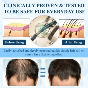 ATTDX® Hair Reawaken PP405 Roll-On Serum 10 ATTDX® Hair Reawaken PP405 Roll-On Serum