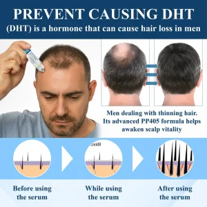 ATTDX® Hair Reawaken PP405 Roll-On Serum 9 ATTDX® Hair Reawaken PP405 Roll-On Serum