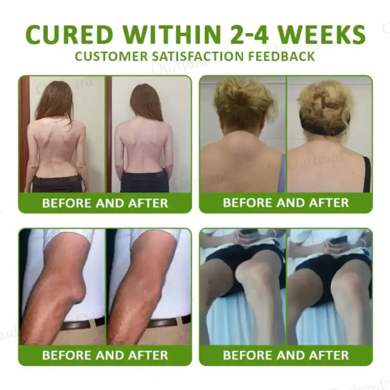 NovaRX® Magnesium & Peppermint Arthritis Pain Relief and Bone Healing Cream 5 NovaRX® Magnesium & Peppermint Arthritis Pain Relief and Bone Healing Cream