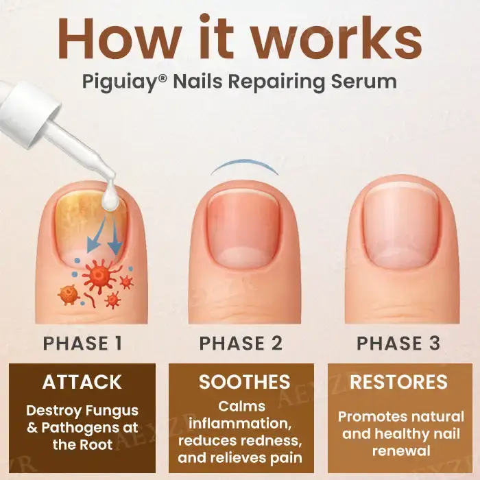 Piguiay® Nails Repairing Serum 6 Piguiay® Nails Repairing Serum