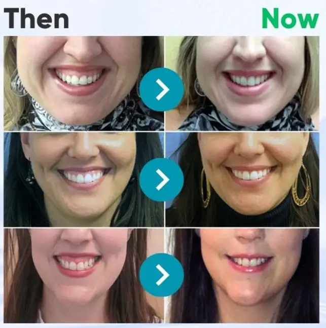 Dobshow® Bee Venom Dental Microgranules 3 Dobshow® Bee Venom Dental Microgranules