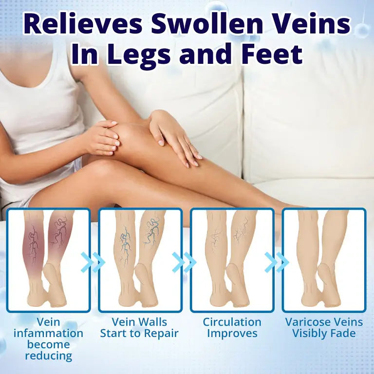 Cvreoz® VeinErase MicroNeedle Repair Patch 3 Cvreoz® VeinErase MicroNeedle Repair Patch