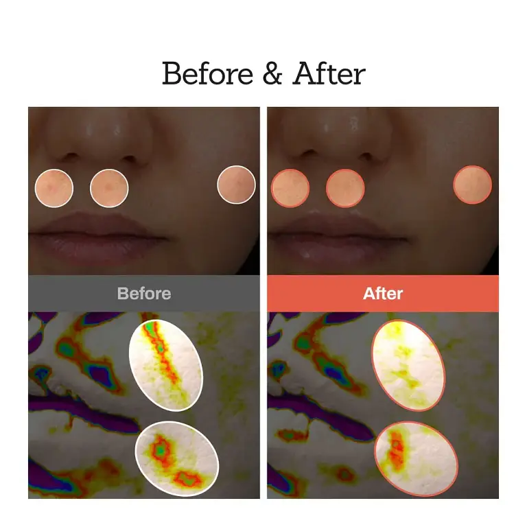 NESLEMY™Retinal Skin Booster Serum 3 NESLEMY™Retinal Skin Booster Serum