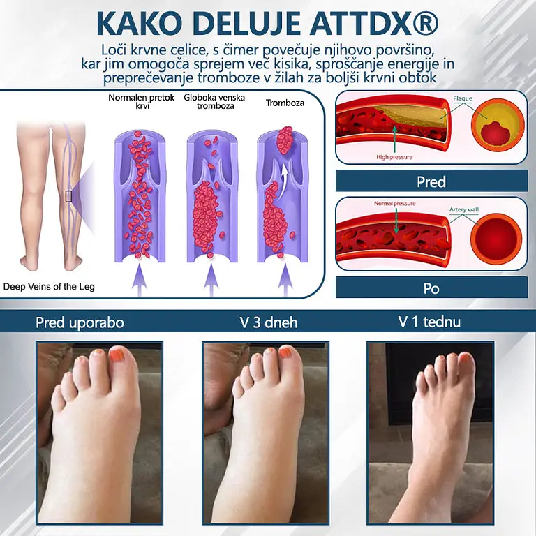 ATTDX® Black Cumin – herbal cream to soothe swelling 2 ATTDX® Black Cumin – herbal cream to soothe swelling