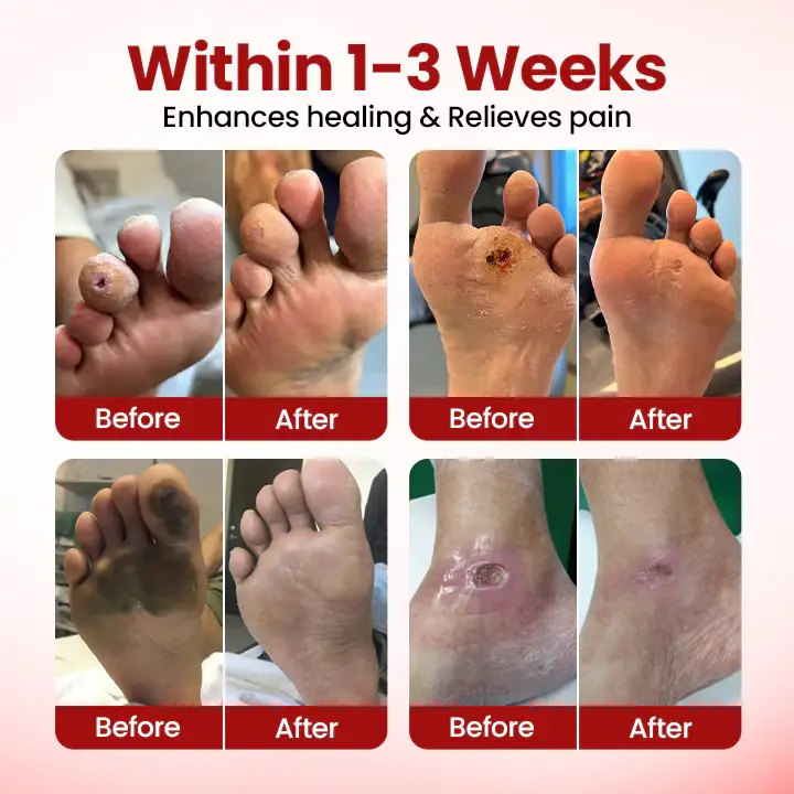 Yagoo® VitaGluco Diabetic Care Cream 3 Yagoo® VitaGluco Diabetic Care Cream