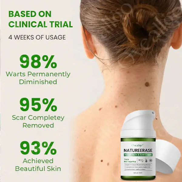 Oveallgo® NatureErase Instant Mole & Spot Cream 3 Oveallgo® NatureErase Instant Mole & Spot Cream