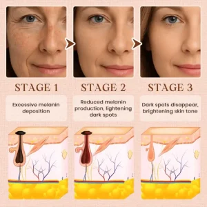 Luhaka®️ Purifying Exfoliating Gel for Acanthosis Nigricans 11 Luhaka®️ Purifying Exfoliating Gel for Acanthosis Nigricans