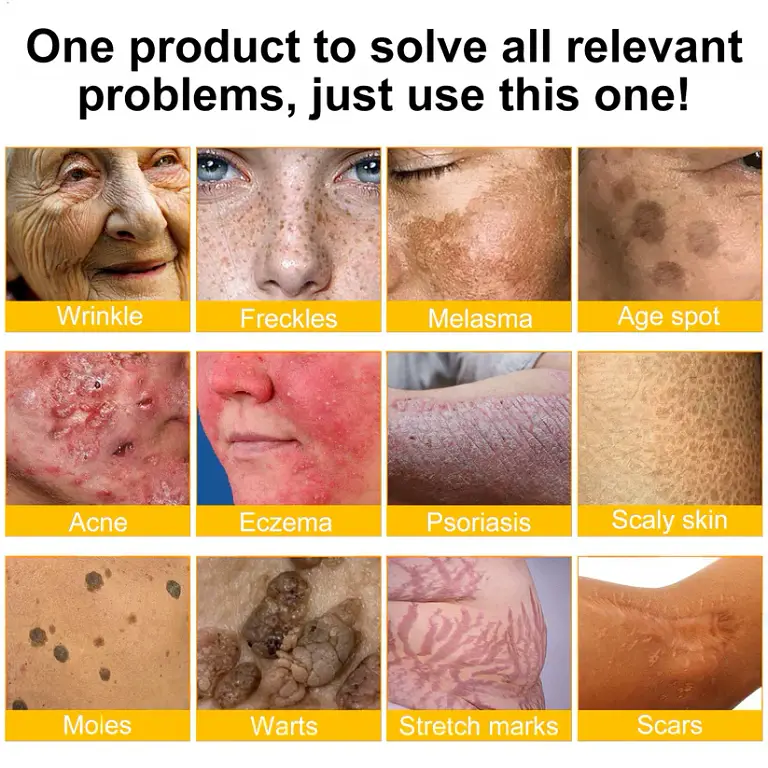 ODALIT® Bee Venom Skin Restoration Cream 5 ODALIT® Bee Venom Skin Restoration Cream