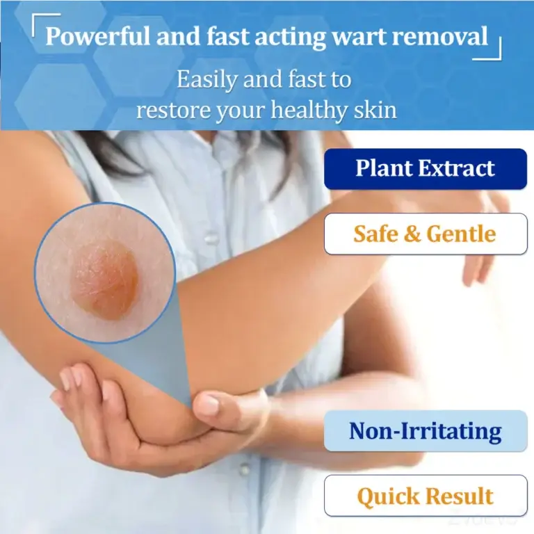 Zvoevo® BeeDerm RX Cream, Painless, Targeted Treatment for Warts 3 Zvoevo® BeeDerm RX Cream, Painless, Targeted Treatment for Warts