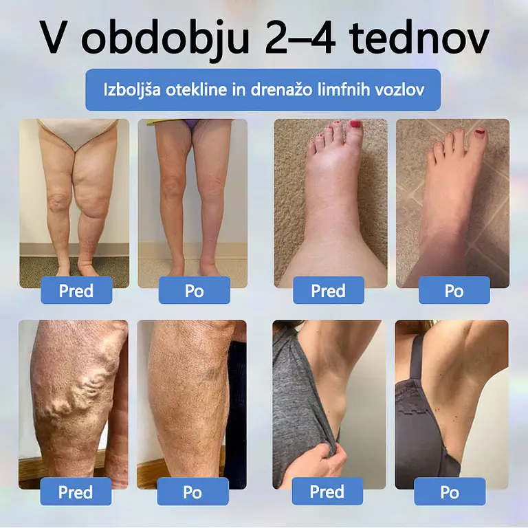 ATTDX® Black Cumin – herbal cream to soothe swelling 5 ATTDX® Black Cumin – herbal cream to soothe swelling