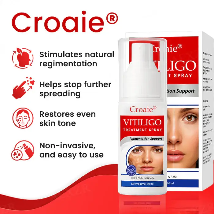 Croaie® Vitiligo Treatment Spray – No allergies 5 Croaie® Vitiligo Treatment Spray – No allergies