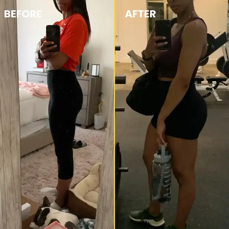 Elcator BBL Vitaldrops 3 Elcator BBL Vitaldrops