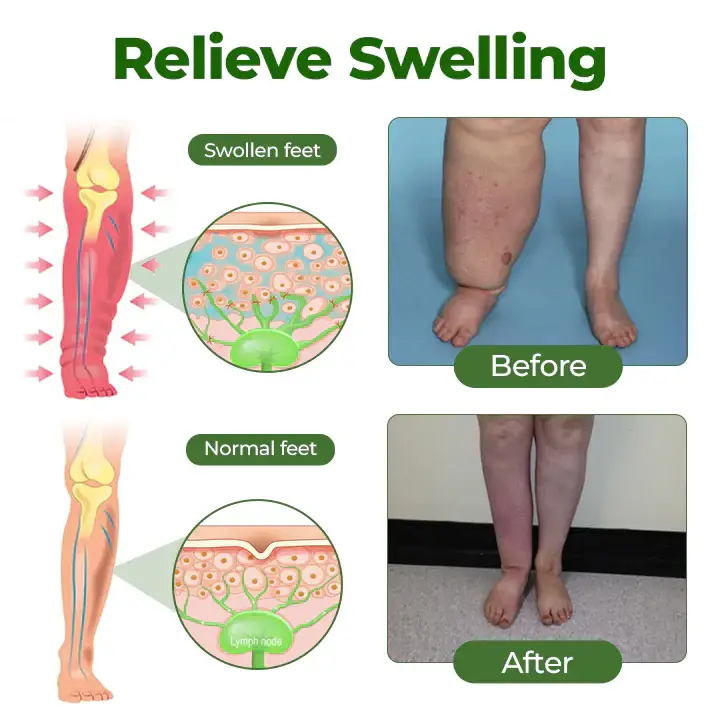 NovaRX® FluidEase Leg Therapy Edema Cream 3 NovaRX® FluidEase Leg Therapy Edema Cream