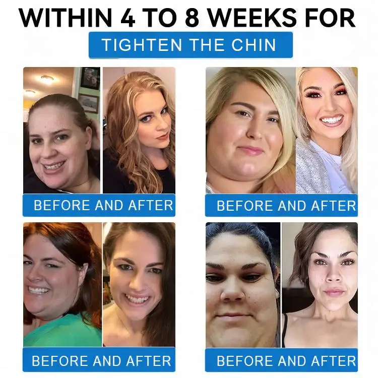 LBMLBM® SMGT-GLP-1 Tirzepatide & Collagen Nano Microneedle Weight Loss Patch 3 LBMLBM® SMGT-GLP-1 Tirzepatide & Collagen Nano Microneedle Weight Loss Patch