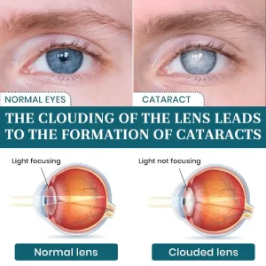 Lyyeto® OptiFusion Nano Eye Drops Serum 9 Lyyeto® OptiFusion Nano Eye Drops Serum