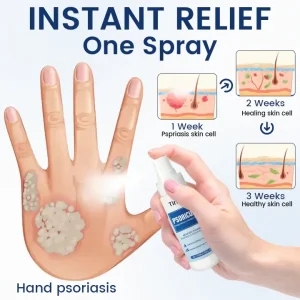 Timilk® PsoriCure Magnesium Herbal Spray 9 Timilk® PsoriCure Magnesium Herbal Spray