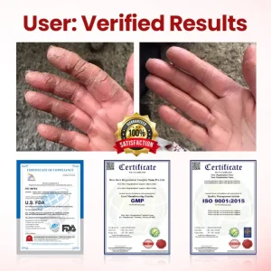 Yagoo® VitaGluco Diabetic Care Cream 10 Yagoo® VitaGluco Diabetic Care Cream