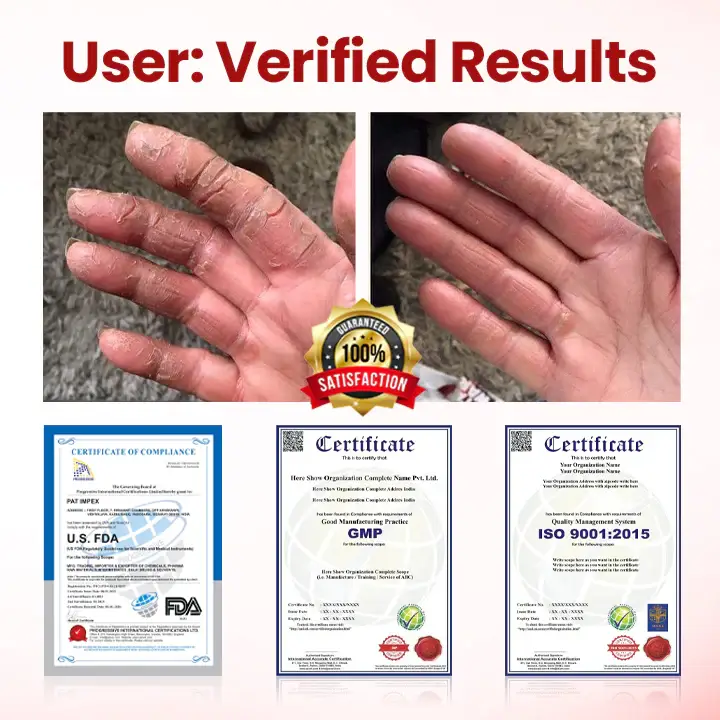 Yagoo® VitaGluco Diabetic Care Cream 5 Yagoo® VitaGluco Diabetic Care Cream