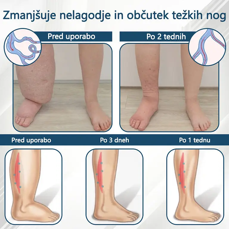 ATTDX® Black Cumin – herbal cream to soothe swelling 3 ATTDX® Black Cumin – herbal cream to soothe swelling