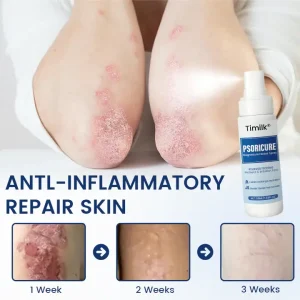 Timilk® PsoriCure Magnesium Herbal Spray 8 Timilk® PsoriCure Magnesium Herbal Spray