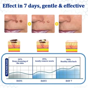 Zvoevo® BeeDerm RX Cream, Painless, Targeted Treatment for Warts 10 Zvoevo® BeeDerm RX Cream, Painless, Targeted Treatment for Warts