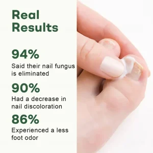 Dobshow® Nail Fungus Renewal Gel 7 Dobshow® Nail Fungus Renewal Gel