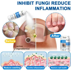 Cvreoz® Magnesium Herbal Psoriasis Spray 10 Cvreoz® Magnesium Herbal Psoriasis Spray