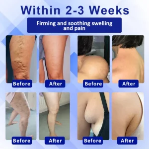 Elycura™ Lymphatic Drainage Massage Cream 5 Elycura™ Lymphatic Drainage Massage Cream